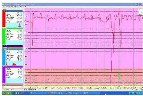 Gigahertz Solutions NFA1000 - Analyse des données: enregistrements à long terme - 1