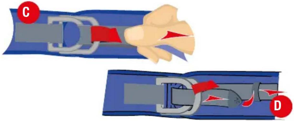 Medical illustration showing a hand holding a car seatbelt with red arrows indicating force or movement, labeled C and D.