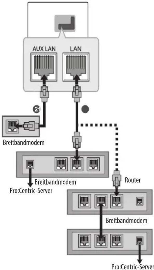 LG 75UW341C - Kabelgebundene Netzwerkverbindung - 1