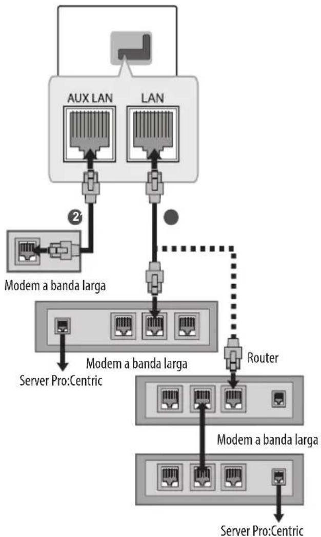 LG 75UW341C - Connessione della rete cablata - 1