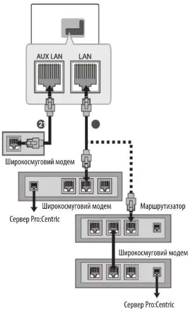 LG 75UW341C - Дротове мережеве з'єднання - 1