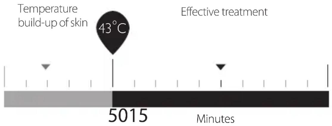SILKN FaceTite H2111 - Treatment plan - 1