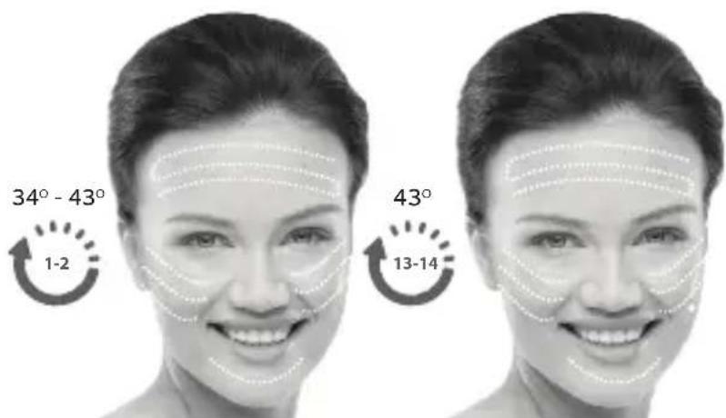 SILKN FaceTite H2120 - Legen Sie los! - 2