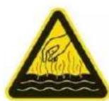 CASO HW 400 - WARNING Advertencia - 1