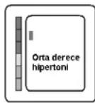 Scala SC 6400 - Recalibrage ultérieur périodique - 1
