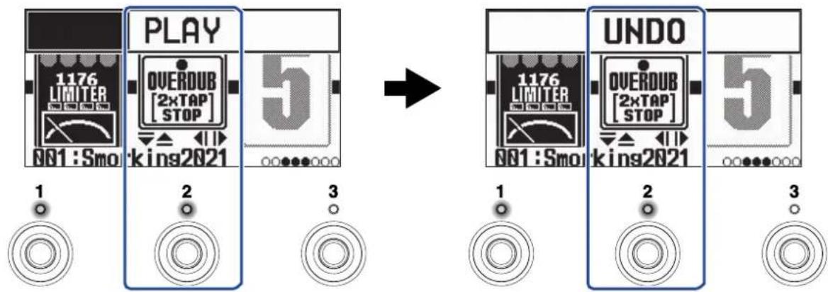 ZOOM G2X Four - 删除最近一次叠加录音 (UNDO 功能) - 2
