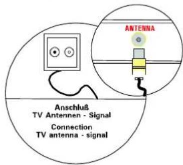 MEDION LIFE P15025 (MD 20410) - Anschließen und Einschalten - 1