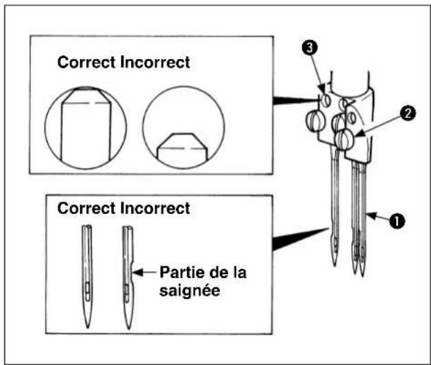 Correct Incorrect Correct Incorrect Partie de la saignée
