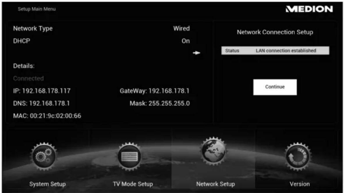 MEDION LIFE P85252 (MD 86883) - Configurer une connexion LAN - 1
