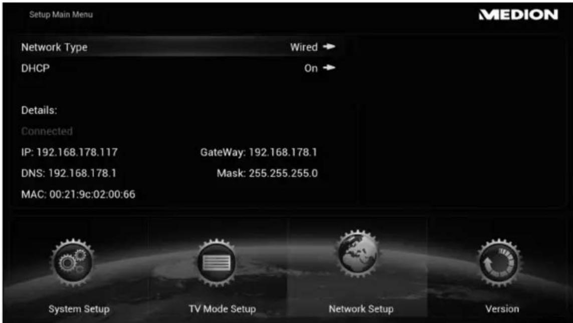 MEDION LIFE P85252 (MD 86883) - Network Setup - 1