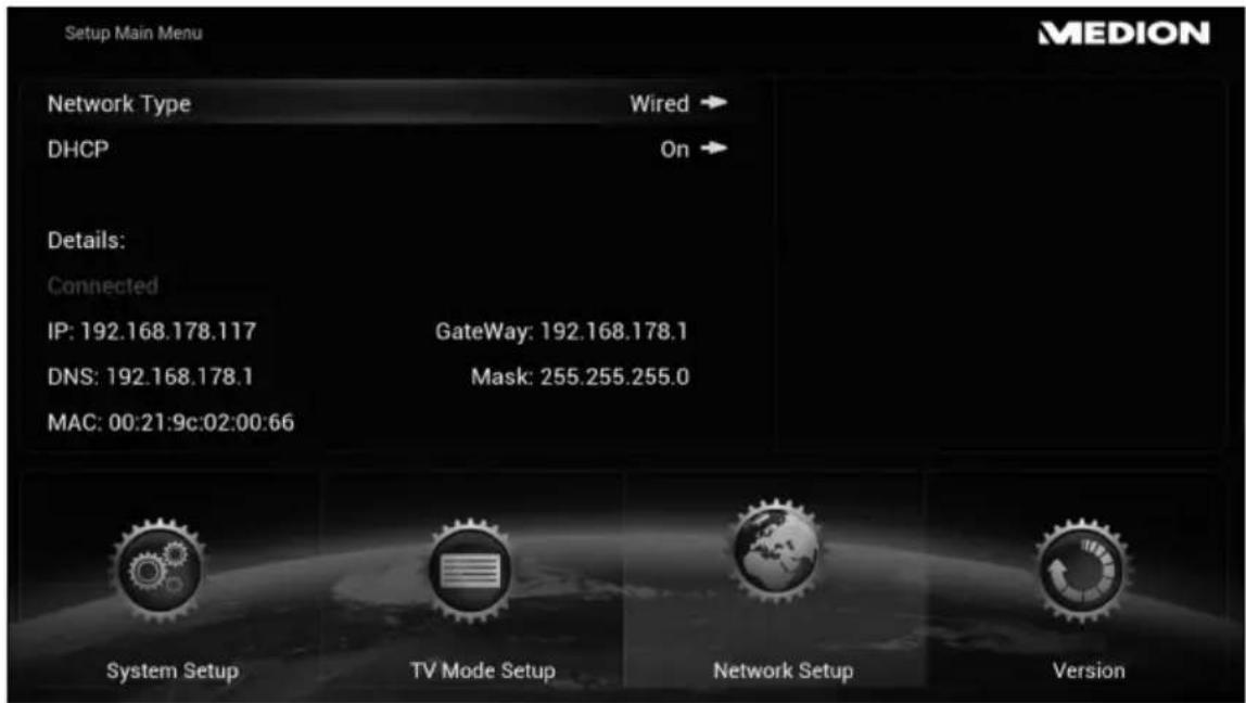 MEDION LIFE P85252 (MD 86883) - Network Setup - 1