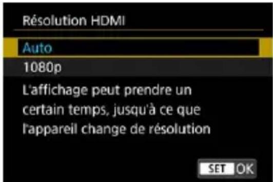 Résolution HDMI Auto 1080p L'affichage peut prendre un certain temps, jusqu'à ce que l'appareil change de résolution SET OK