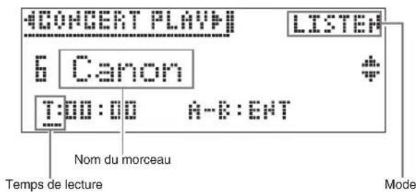 CASIO Celviano GP300 - Appuyez sur la touche CONCERT PLAY. - 2