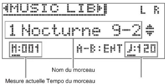 CASIO Celviano GP300 - Utilisez les touches directionnelles < et > pour sélectionner « MUSIC LIB ». - 1