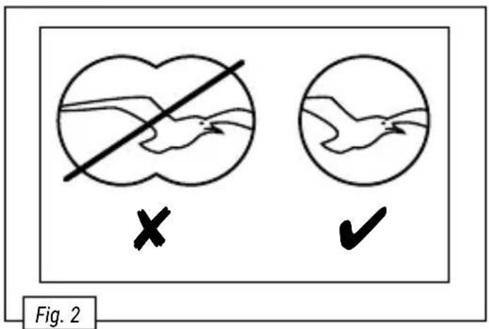 Fig. 2