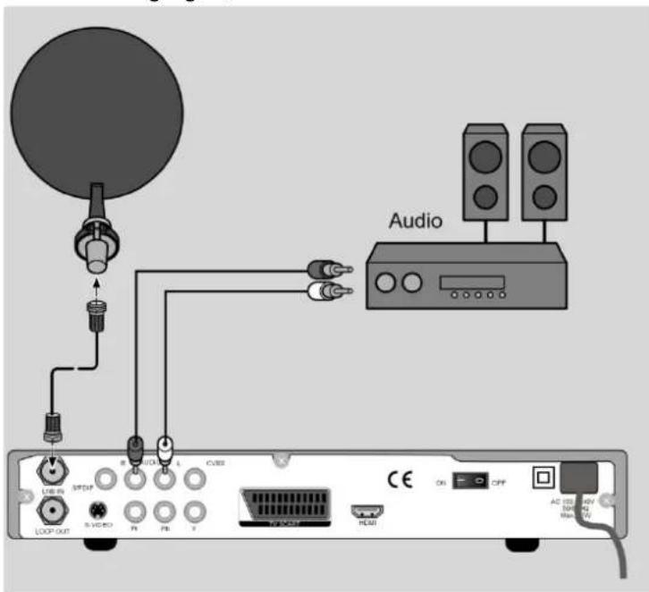 MEDION LIFE P24003 (MD 24115) - Audio-Anlage - analog - 1