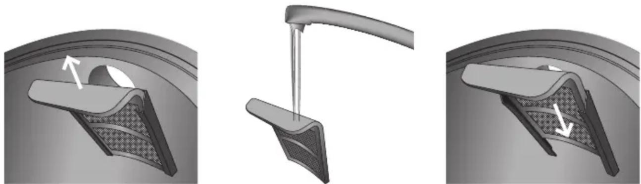 GRAEF WK 902 - ENTNAHME DES KALKFILTERS - 1