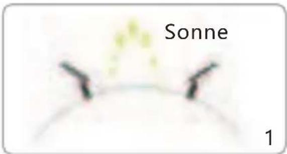 Sonne 1