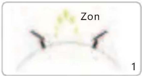 Zon 1