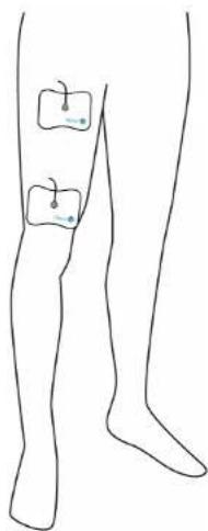 PAINGONE Fllow - Application des électrodes Arthro-Flow - 2