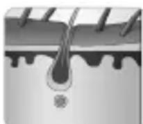 BEURER IPL 7800 Cool Pro - Funktionsweise der IPL-Technologie - 2