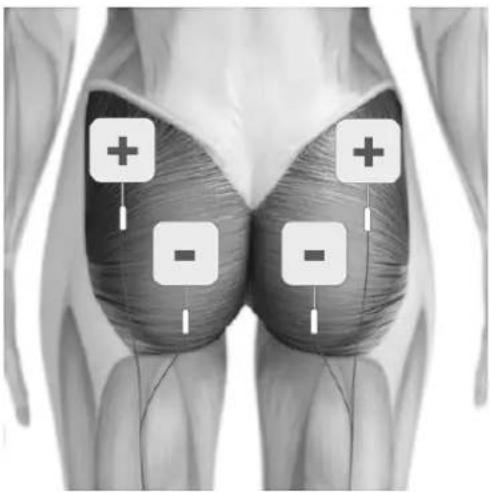 TensCare Uniglo - POSITIONNEMENT DES ELECTRODES - 6
