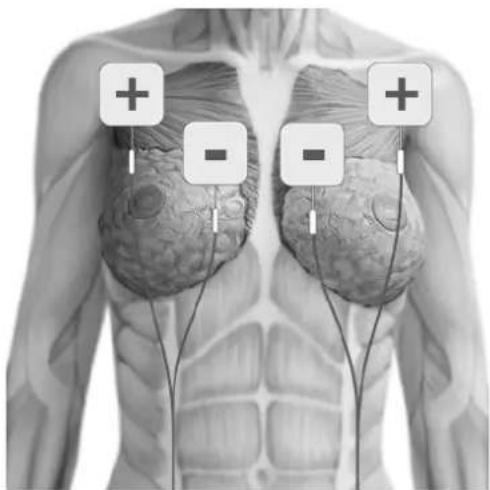 TensCare Uniglo - POSITIONNEMENT DES ELECTRODES - 8