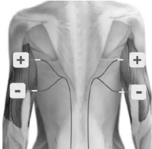 TensCare Uniglo - POSITIONNEMENT DES ELECTRODES - 9