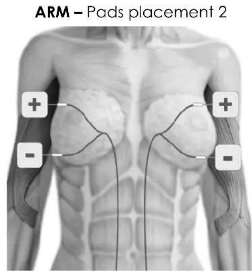TensCare Uniglo - ELECTRODE PLACEMENT - 15