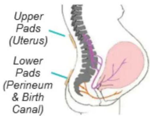 TensCare Perfect MamaTENS - ESPECIFICACIONES GENERALE - 3