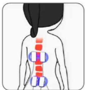 TensCare Perfect PFE - Pain Gate - 1