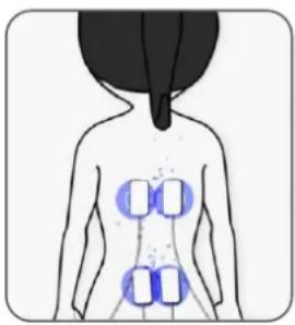TensCare Perfect PFE - Endorphin Release - 1