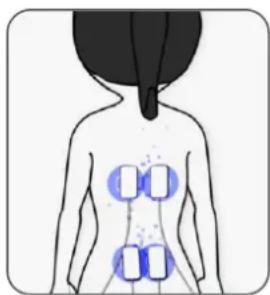 TensCare Perfect PFE - Endorphin-Freisetzung - 1