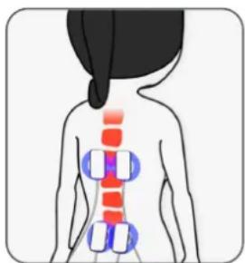 TensCare Perfect TENS - Pain Gate - 1