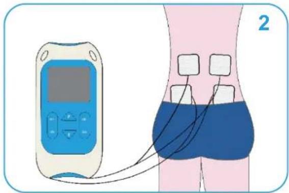 TensCare Perfect TENS - perfect TENS - 3