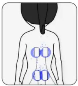 TensCare Perfect TENS - Endorphin-Freisetzung - 1