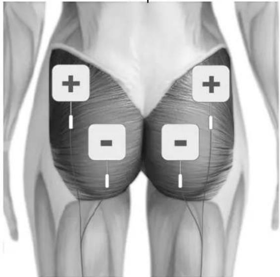 TensCare Perfect EMS - PAD ADVICE - 5