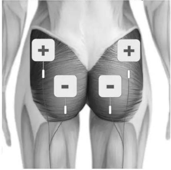 TensCare Perfect EMS - EMS ELECTRODEN PLAZIERUNG - 4