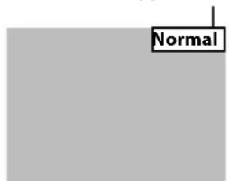 Normal