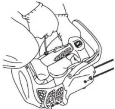 Tanaka TCS-3351PFS - IMPORTANT! - 3
