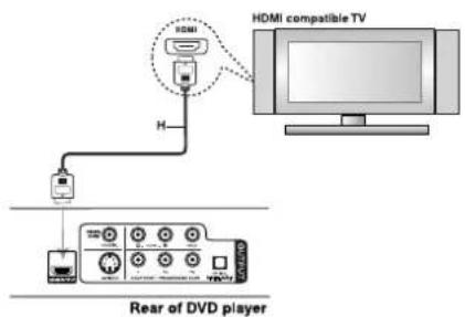 HDMI compatible TV H Rear of DVD player