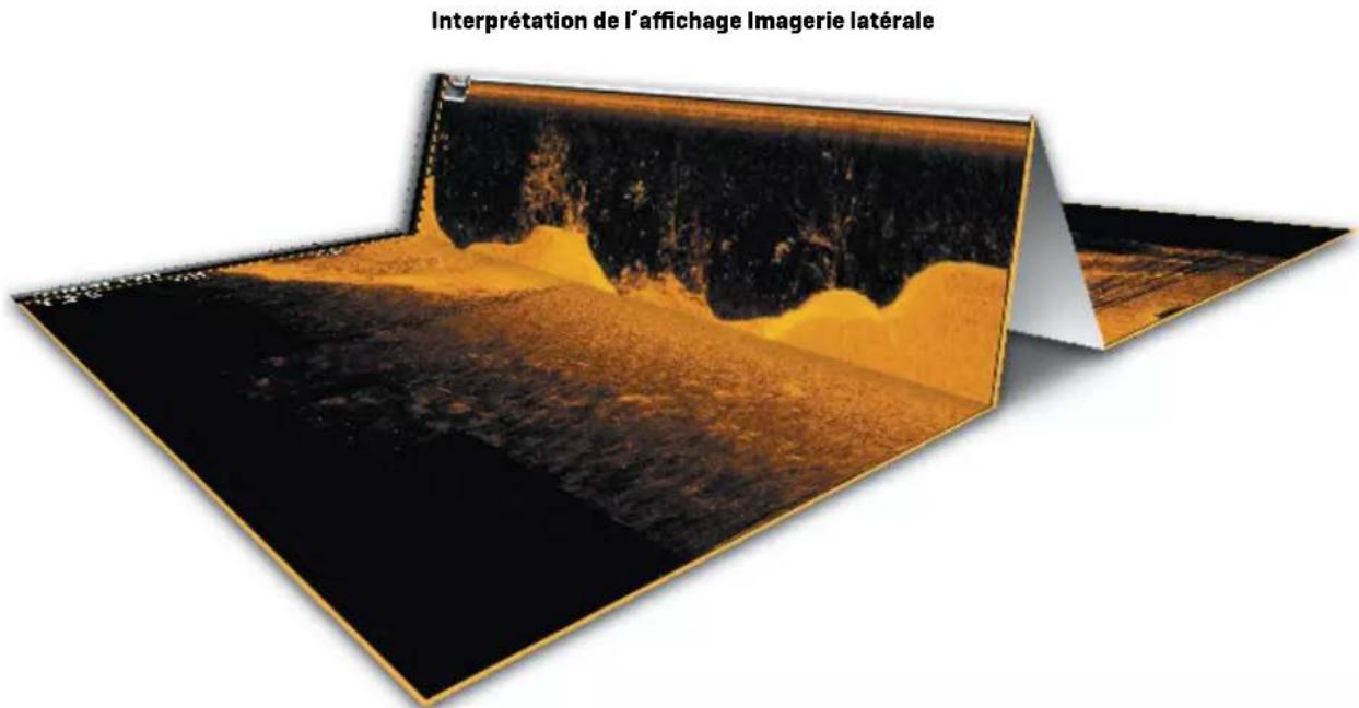 Interprétation de l'affichage Imagerie latérale