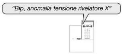 HAGER RLA145X - Segnalazione delle anomalie - 1