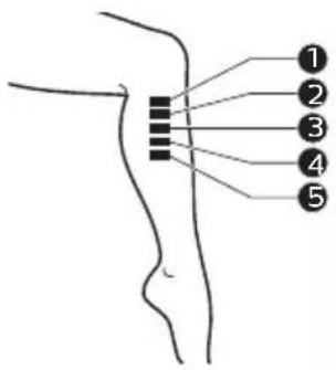 Anatomical diagram of human leg with numbered labeled points pointing to specific regions.