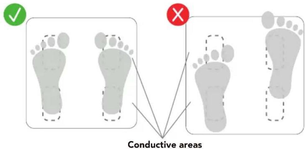 ✓ Conductive areas