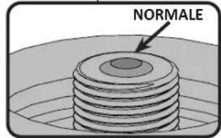 NORMALE