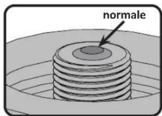 normale