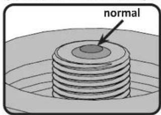 normal