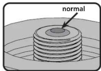 normal