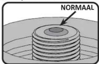 NORMAAL